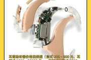 瑞音科技助听器怎么样_瑞音科技助听器价格贵吗