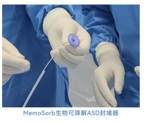 先健科技产品有哪些_先健科技心脏封堵器怎么样