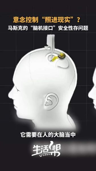 2030年脑机接口安全吗_脑机接口如何改变生活